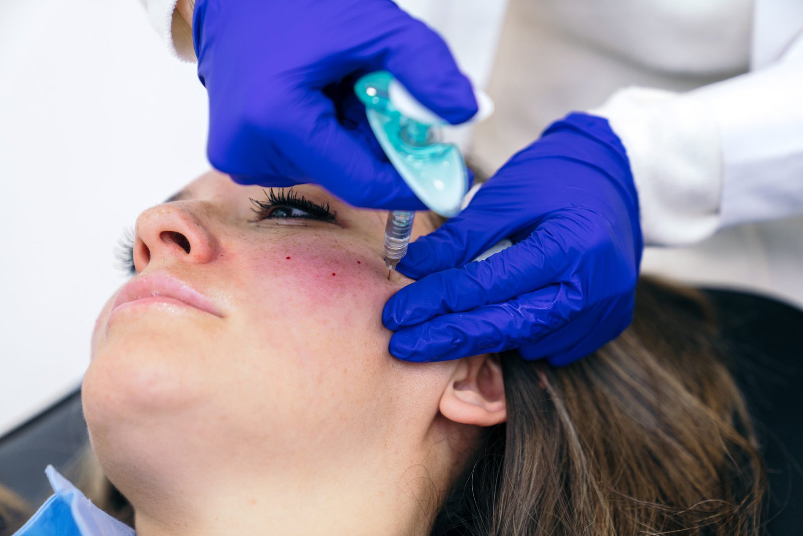 Aesthetician administers a precise hyaluronic acid injection into a patient's chin, focusing on cosmetic enhancement and care.