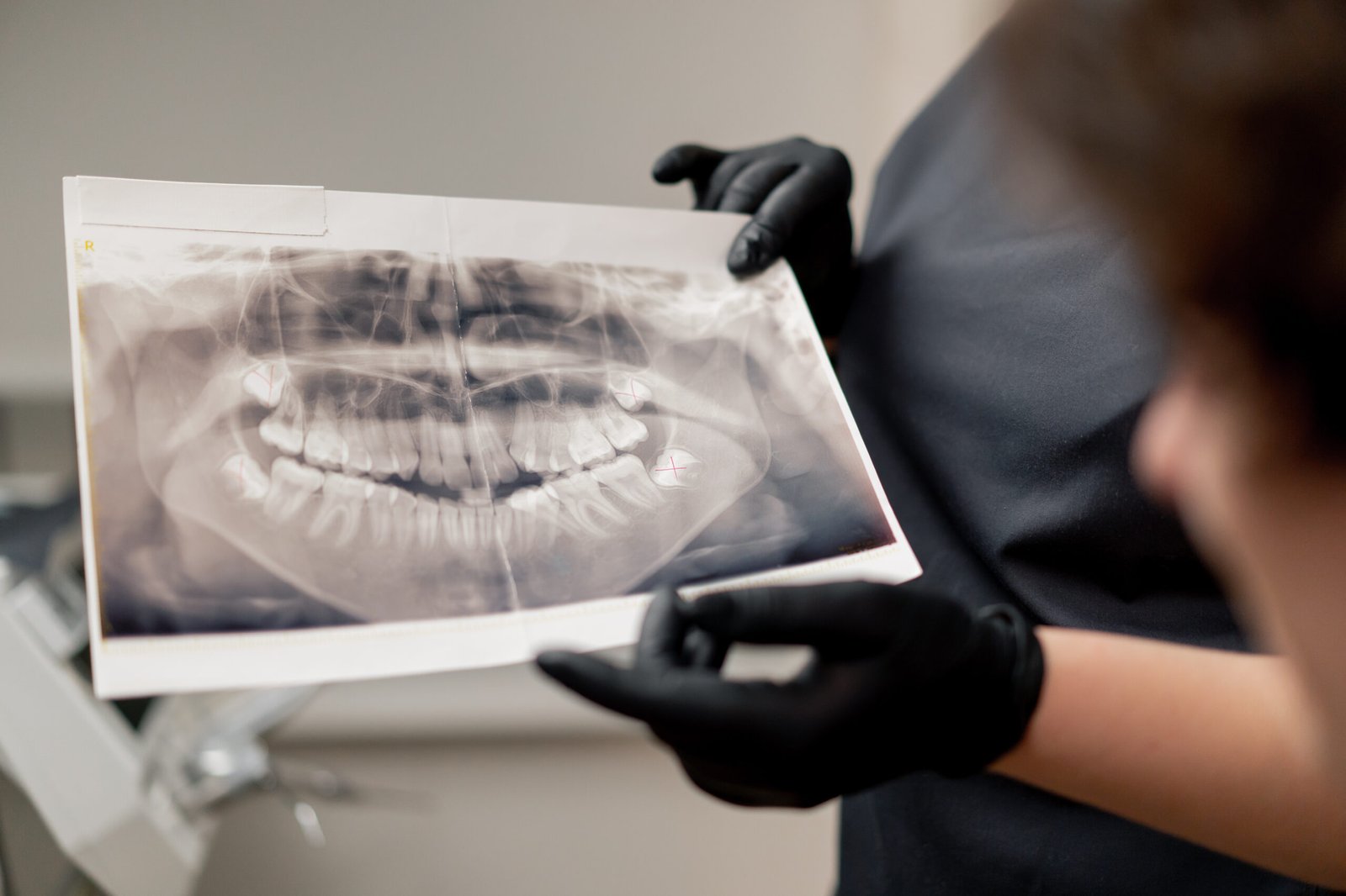 close up dental office blonde dentist in a black uniform consulting a patient showing a photo of the teeth