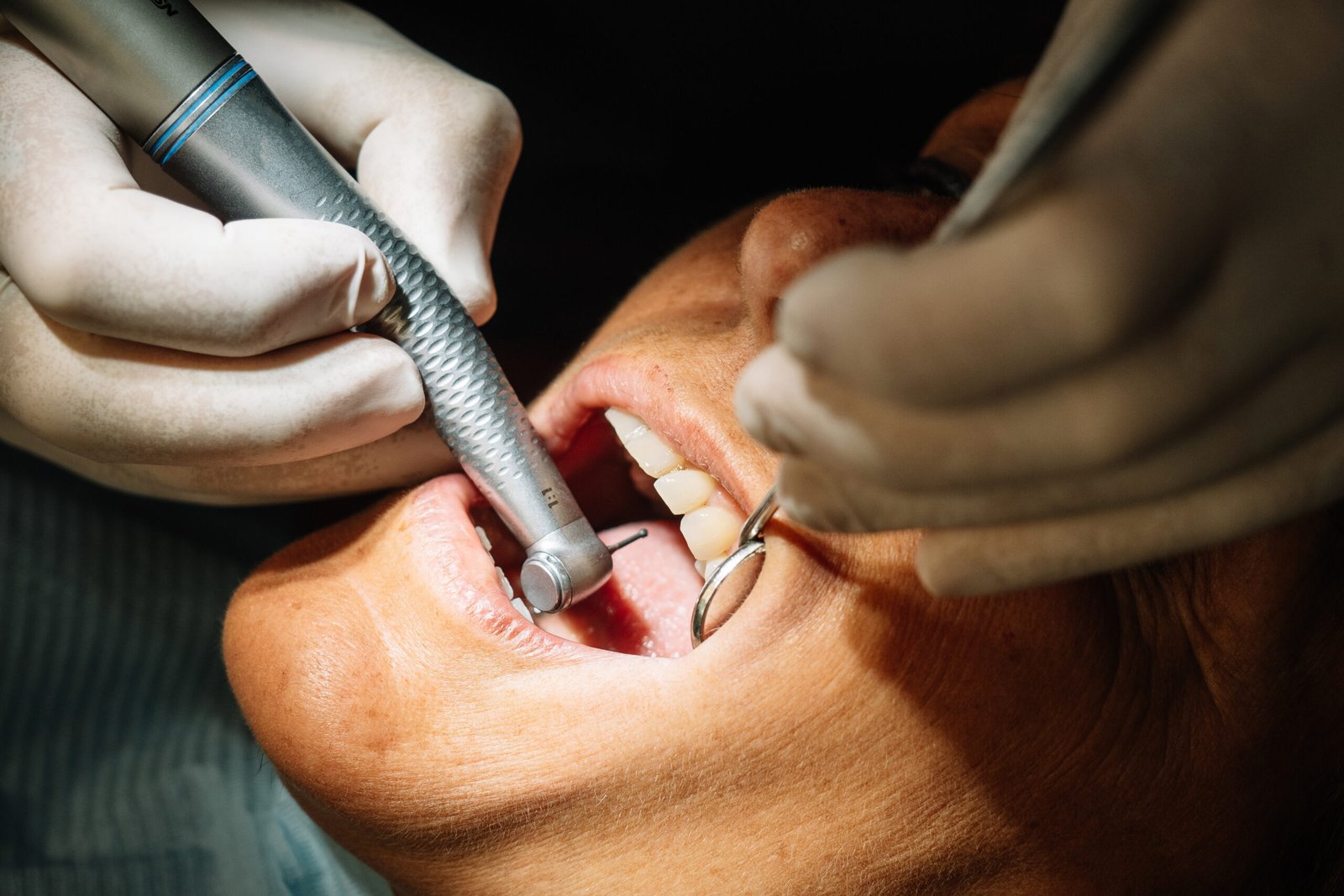Dentist opens the mouth of his patient and begins to revise the interior helped by his instruments